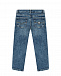 Заженные джинсы с разрезами Guess | Фото 2