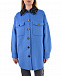 Голубая куртка-рубашка с кружевным воротником  | Фото 8
