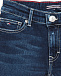 Укороченные джинсы Tommy Hilfiger | Фото 3
