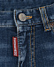 Синие джинсовые шорты Dsquared2 | Фото 3