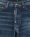 Темно-синие джинсовые бермуды Dsquared2 | Фото 3