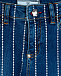 Брюки джинсовые Philipp Plein  | Фото 3
