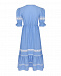 Голубое платье с кружевной отделкой  | Фото 3